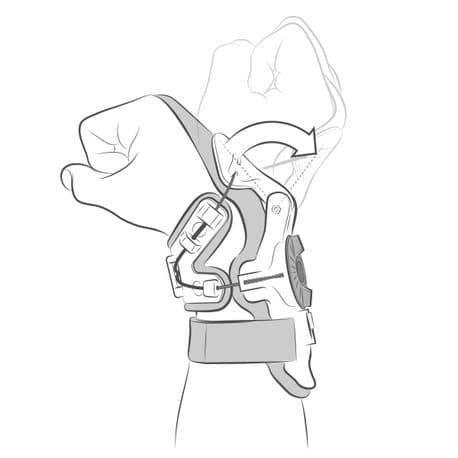 Mobius X8 Wrist wire Kit